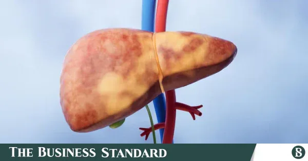 Shift in Bangladesh's liver disease landscape: Rise in fatty liver cases